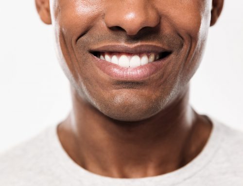Your Dental Veneers Guide at Smile360 Dental Specialists: The Cost, Procedure and More