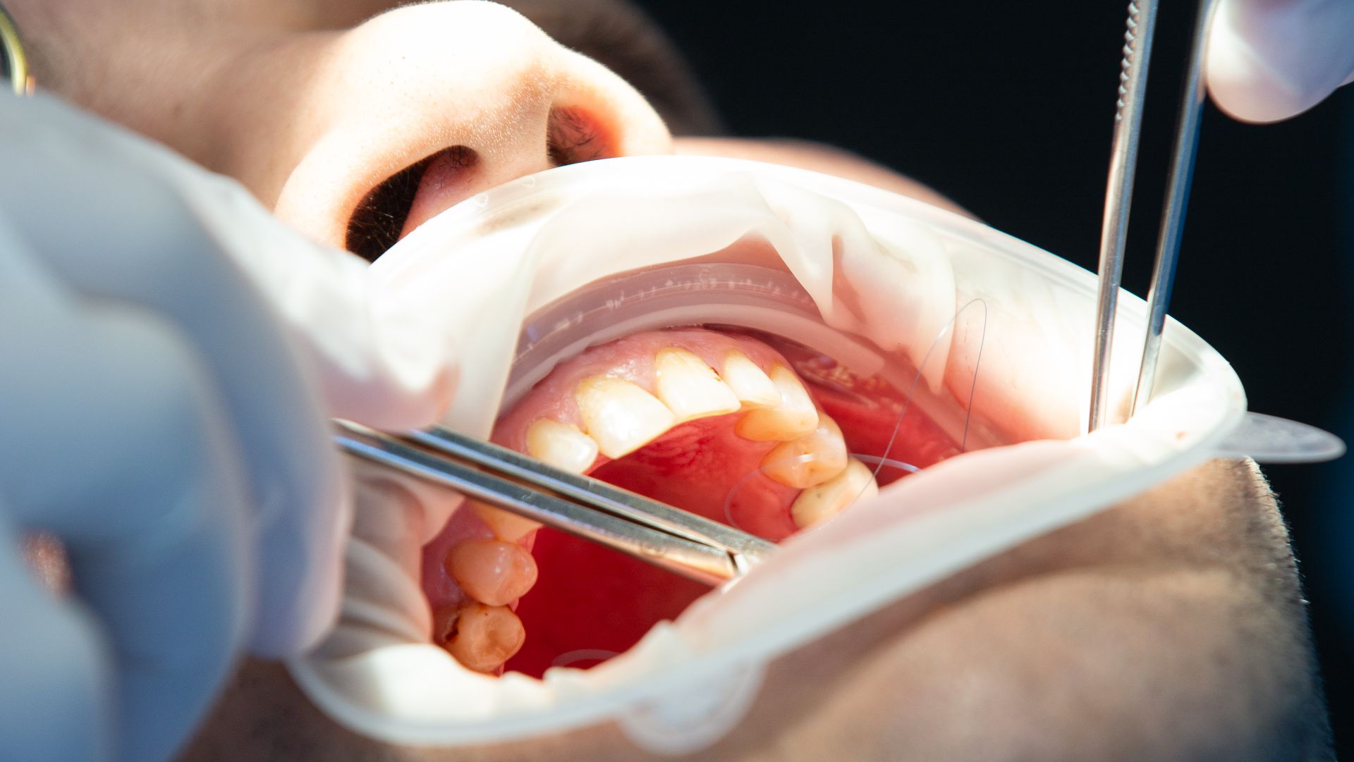 Inside the Dental Surgery: What to Expect During Procedures