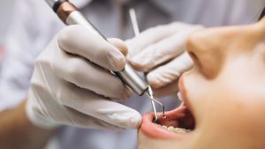 Root Canal Treatment vs. Tooth Extraction: Which Is Right for You?